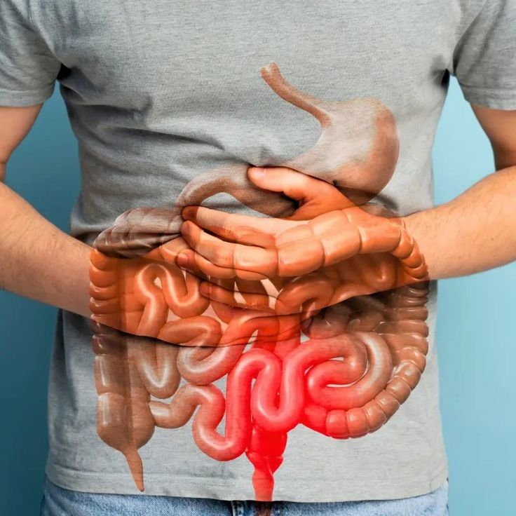 WellnessCave™ Gut Support Capsule