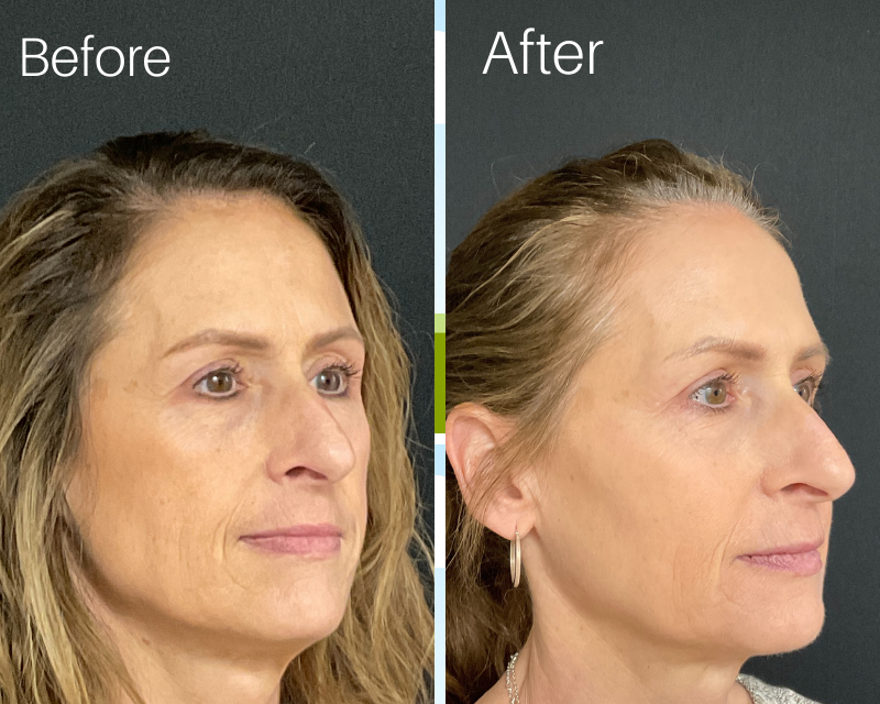 WellnessCave™ Cata-Kor NAD+ Anti-Aging Supplement