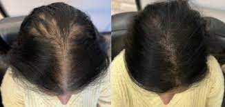 WellnessCave™ Hair Growth Accelerator Soft Chews